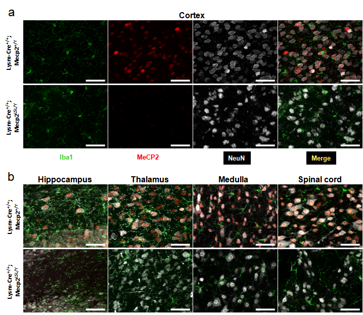 Mecp2TM2Bird does not express detectable levels of MeCP2 protein.